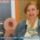 11. Regionalna konferencija o melanomu; Udruženje pacijenata Osmeh