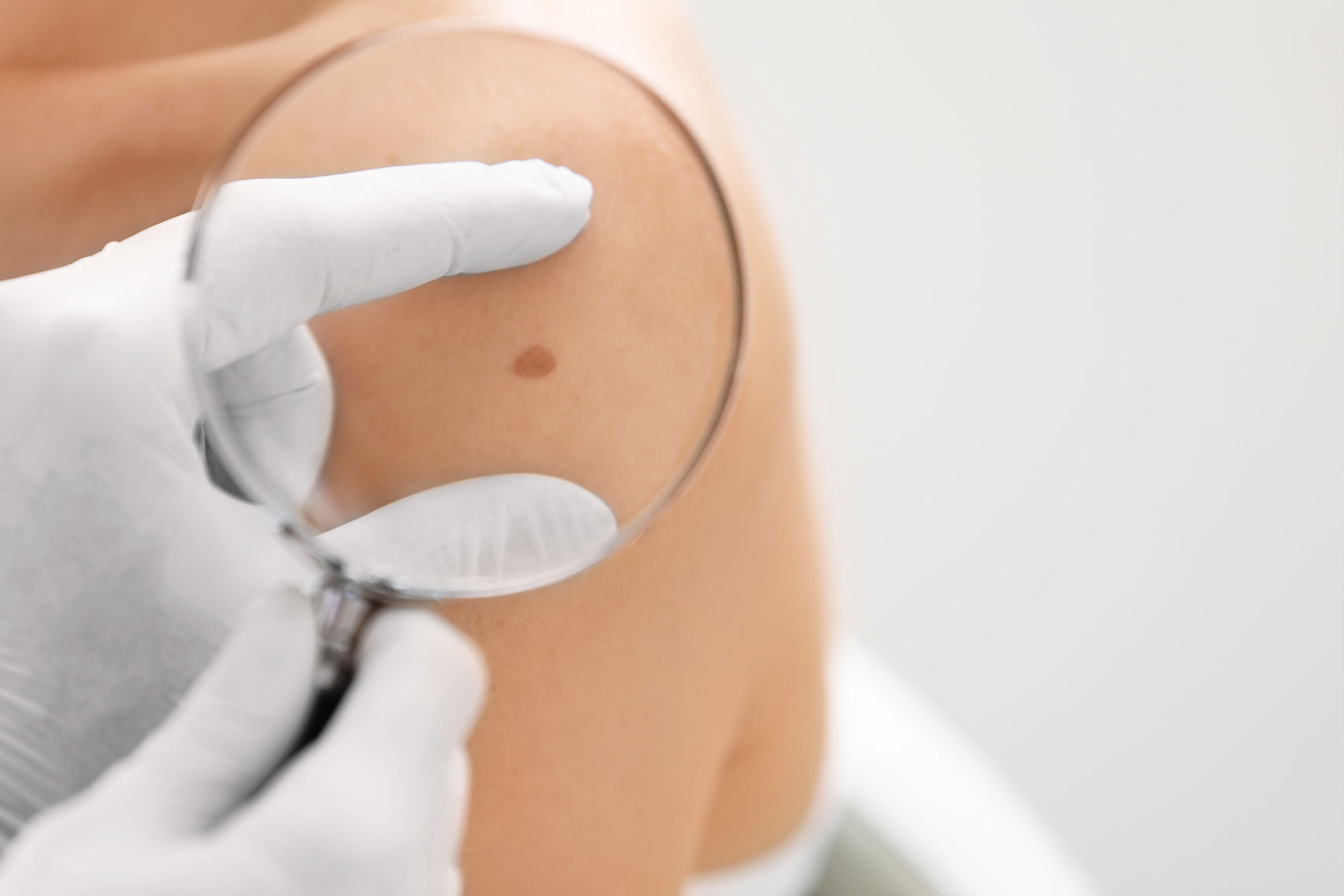 udruzenje-osmeh-pocetna Dermatoloski pregled mladeza; Udruženje pacijenata Osmeh